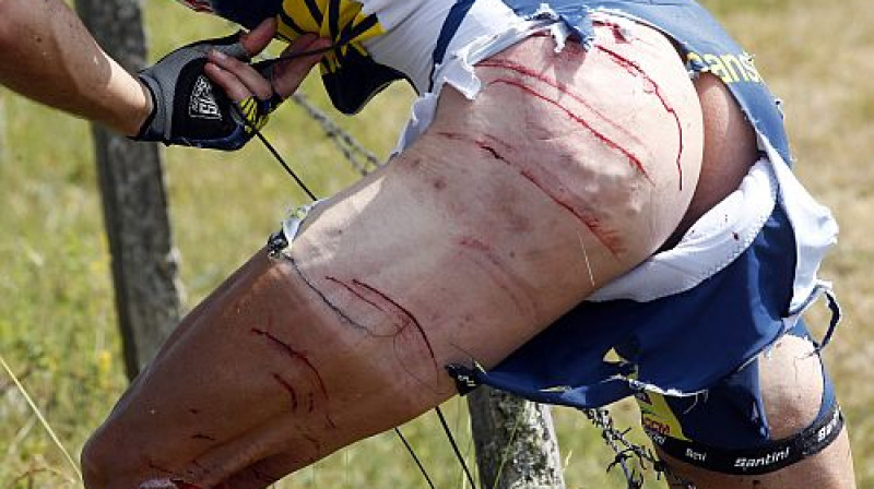 Dzeloņdrāšu upuris Džonijs Hogerlands
Foto: Reuters/Scanpix